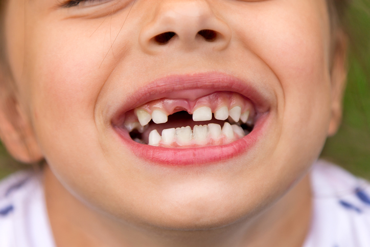 Little girl fell a baby tooth